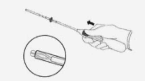 Push the slider forward in the direction of the arrow to the furthest position to load the LNG-IUS into the insertion tube.