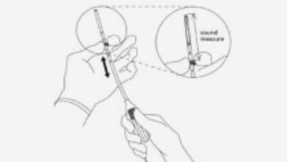 Holding the slider in the furthest position, set the upper edge of the flange to correspond to the sound measurement of the uterine depth.