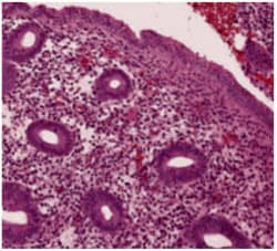 histological-classification-slider-2
